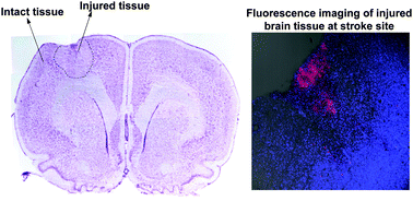 Graphical abstract: Organic nanoparticles with aggregation-induced emission for tracking bone marrow stromal cells in the rat ischemic stroke model