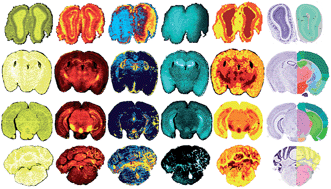 Graphical abstract: Visualising mouse neuroanatomy and function by metal distribution using laser ablation-inductively coupled plasma-mass spectrometry imaging