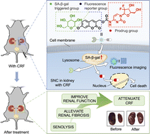 Graphical abstract: A senolysis-based theragnostic prodrug strategy towards chronic renal failure