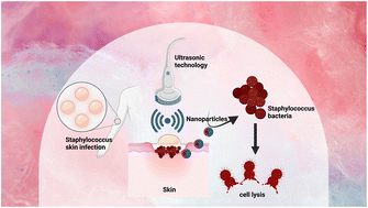 Graphical abstract: Ultrasonic nanotechnology for the effective management of Staphylococcus aureus skin infections: an update