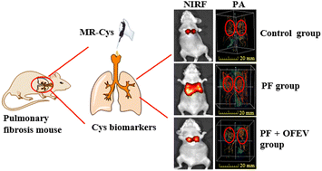 Graphical abstract: Development of cysteine-sensitive bimodal probes for in situ monitoring of early-stage pulmonary fibrosis progression and therapeutic effects
