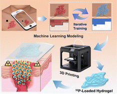 Graphical abstract: A customizable 32P hydrogel applicator for brachytherapy of skin hemangioma based on machine learning and 3D-printing