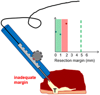 Intraoperative assessment of resection margins by Raman spectroscopy to ...