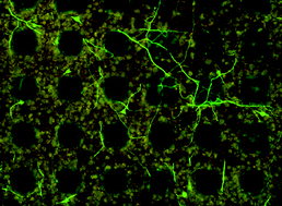 Graphical abstract: Electroactive polymers for neural interfaces