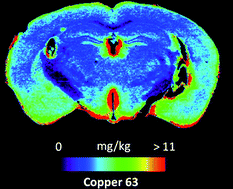 Graphical abstract: Improving acquisition times of elemental bio-imaging for quadrupole-based LA-ICP-MS