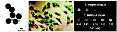 Graphical abstract: Preparation and characterization of ZnS:Tb,Gd and ZnS:Er,Yb,Gd nanoparticles for bimodal magnetic-fluorescent imaging