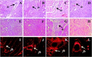 Graphical abstract: Chronic l-arginine treatment improves metabolic, cardiovascular and liver complications in diet-induced obesity in rats