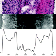 Graphical abstract: Digital holographic microscopy quantifies the degree of inflammation in experimental colitis