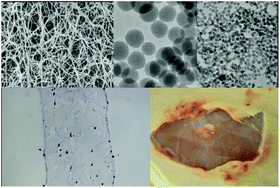 Graphical abstract: Bio-inspired silica–collagen materials: applications and perspectives in the medical field