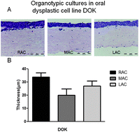 Graphical abstract: Human oral cancer cells with increasing tumorigenic abilities exhibit higher effective membrane capacitance