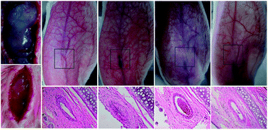 Graphical abstract: In vivo synergetic effect of in situ sclerotherapy and transient embolotherapy designed for fast-flow vascular malformation treatments with the aid of injectable hydrogel