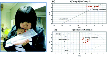 Graphical abstract: Analysis of human breath samples of lung cancer patients and healthy controls with solid-phase microextraction (SPME) and flow-modulated comprehensive two-dimensional gas chromatography (GC × GC)