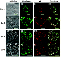 Graphical abstract: A fluorescent light-up probe with AIE characteristics for specific mitochondrial imaging to identify differentiating brown adipose cells