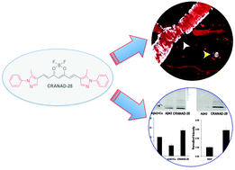 Graphical abstract: A bifunctional curcumin analogue for two-photon imaging and inhibiting crosslinking of amyloid beta in Alzheimer's disease
