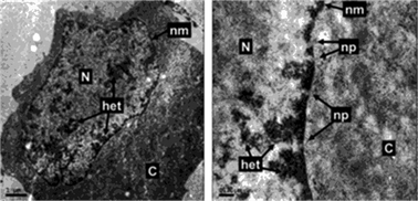 Graphical abstract: Dinuclear osmium(ii) probes for high-resolution visualisation of cellular DNA structure using electron microscopy