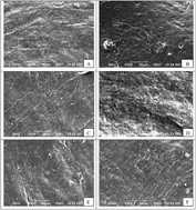 Graphical abstract: Effect of enteral administration of α-linolenic acid and linoleic acid against methotrexate induced intestinal toxicity in albino rats