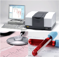 Graphical abstract: Cardiovascular biodiagnosis by infrared spectroscopy through choline determination