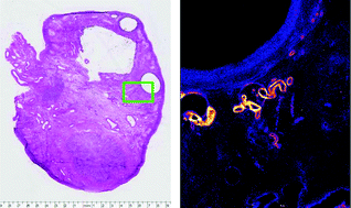 Graphical abstract: Quantitative elemental analysis of bovine ovarian follicles using X-ray fluorescence imaging