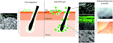 Graphical abstract: Development of a topical adapalene-solid lipid nanoparticle loaded gel with enhanced efficacy and improved skin tolerability