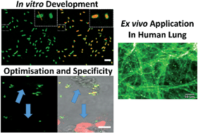 Graphical abstract: A labelled-ubiquicidin antimicrobial peptide for immediate in situ optical detection of live bacteria in human alveolar lung tissue