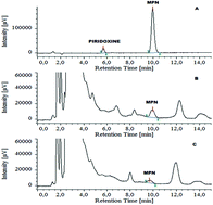 Graphical abstract: Identification and quantification of biomarkers to confirm the poisoning by Ginkgo biloba seeds in a 2-year-old boy