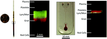 Graphical abstract: Differential leukocyte counting via fluorescent detection and image processing on a centrifugal microfluidic platform