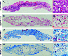 Graphical abstract: Development of demineralized bone matrix-based implantable and biomimetic microcarrier for stem cell expansion and single-step tissue-engineered bone graft construction