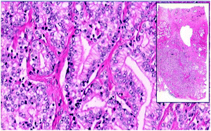 Graphical abstract: Histological coherent Raman imaging: a prognostic review