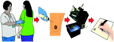 Graphical abstract: Towards a personalized approach to aromatase inhibitor therapy: a digital microfluidic platform for rapid analysis of estradiol in core-needle-biopsies