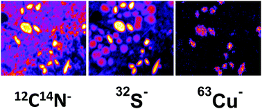 Graphical abstract: Transition metals and trace elements in the retinal pigment epithelium and choroid: correlative ultrastructural and chemical analysis by analytical electron microscopy and nano-secondary ion mass spectrometry