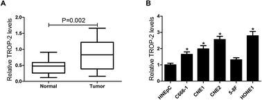 Graphical abstract: Retracted Article: Trop2 promotes proliferation, invasion and EMT of nasopharyngeal carcinoma cells through the NF-κB pathway