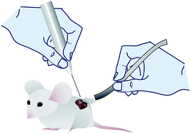Graphical abstract: Rapid determination of medulloblastoma subgroup affiliation with mass spectrometry using a handheld picosecond infrared laser desorption probe