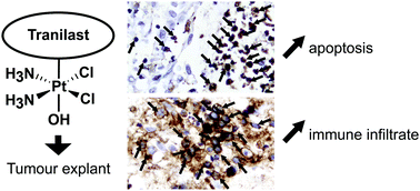 Graphical abstract: Increased immune cell infiltration in patient-derived tumor explants treated with Traniplatin: an original Pt(iv) pro-drug based on Cisplatin and Tranilast