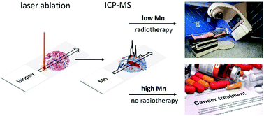 Graphical abstract: Distributions of manganese in diverse human cancers provide insights into tumour radioresistance