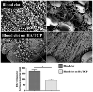 Graphical abstract: Alteration of clot architecture using bone substitute biomaterials (beta-tricalcium phosphate) significantly delays the early bone healing process
