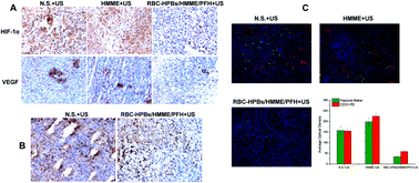 Graphical abstract: Ultrasound induced phase-transition and invisible nanobomb for imaging-guided tumor sonodynamic therapy