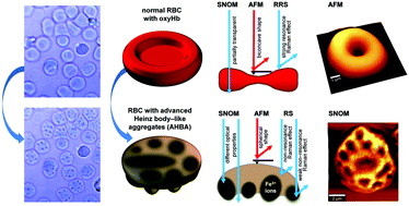 Graphical abstract: Multimodal detection and analysis of a new type of advanced Heinz body-like aggregate (AHBA) and cytoskeleton deformation in human RBCs