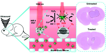 Graphical abstract: Second near-infrared photodynamic therapy and chemotherapy of orthotopic malignant glioblastoma with ultra-small Cu2−xSe nanoparticles