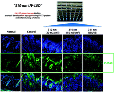 Graphical abstract: 310 nm UV-LEDs attenuate imiquimod-induced psoriasis-like skin lesions in C57BL/6 mice and inhibit IL-22-induced STAT3 expression in HaCaT cells