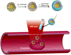 Graphical abstract: Hyperthermia-triggered UK release nanovectors for deep venous thrombosis therapy