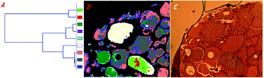 Graphical abstract: Evaluating biochemical differences in thyroglobulin from normal and goiter tissues by infrared spectral imaging