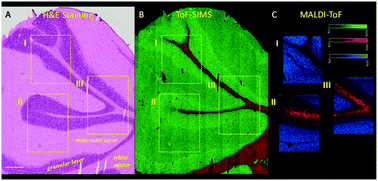 Graphical abstract: Multimodal chemical imaging of a single brain tissue section using ToF-SIMS, MALDI-ToF and immuno/histochemical staining