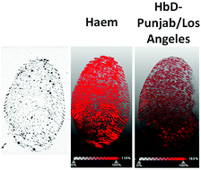 Graphical abstract: Detection and mapping of haemoglobin variants in blood fingermarks by MALDI MS for suspect “profiling”