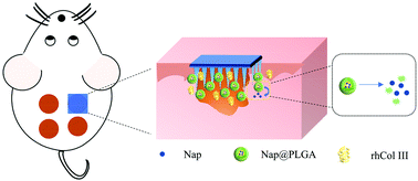 Graphical abstract: Dissolving microneedle-encapsulated drug-loaded nanoparticles and recombinant humanized collagen type III for the treatment of chronic wound via anti-inflammation and enhanced cell proliferation and angiogenesis