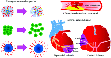 Graphical abstract: Engineered bioresponsive nanotherapeutics: recent advances in the treatment of atherosclerosis and ischemic-related disease