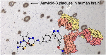 Graphical abstract: Pre-targeting amyloid-β with antibodies for potential molecular imaging of Alzheimer's disease
