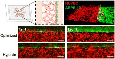 Graphical abstract: Microfluidic outer blood–retinal barrier model for inducing wet age-related macular degeneration by hypoxic stress