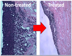 Graphical abstract: Selectively inhibiting malignant melanoma migration and invasion in an engineered skin model using actin-targeting dinuclear RuII-complexes