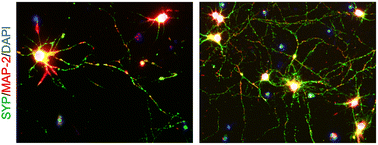 Graphical abstract: Potential use of bioactive nanofibrous dural substitutes with controlled release of IGF-1 for neuroprotection after traumatic brain injury