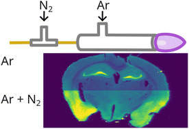 Graphical abstract: Improvement in the sensitivity of LA-ICP-MS bioimaging by addition of nitrogen to the argon carrier gas